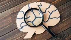 Så får du bättre minne: enkla tips som hjälper dig att inte glömma något